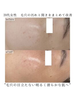 ヴェルシック(Belchic)/無添加でお肌にもやさしい