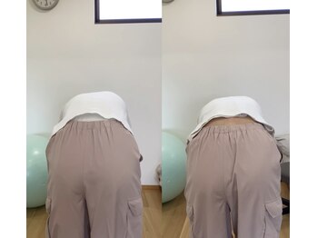 ランドル(rendre)/腰痛、お尻の痛み、背骨の曲がり