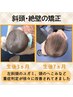 【赤ちゃん・小児整体】頭の形や向き癖、子供の気になる症状にアプローチ