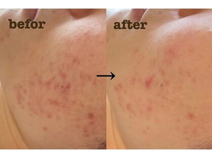 ナチュール(nature)の写真