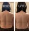 サロン ド ボヌールの写真/贅肉なんとかしたい方へ!サーモシェイプで贅肉スッキリ、頑固な脂肪をケアし整えます◎