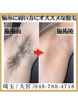 トワ 大宮(TOWA)/~脱毛・症例写真~