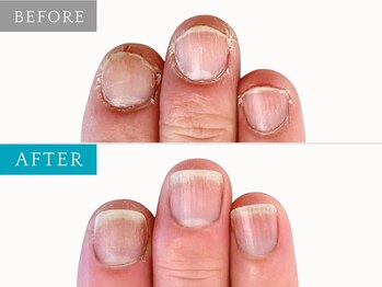 前の爪を忘れていました！