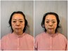 最強【顔＋姿勢矯正】本気の小顔×たるみ改善＆姿勢矯正◆整美メソッド/70分