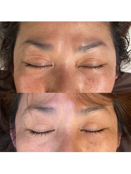 メローワックス 宮崎店(MELLOW WAX)/50代でも若々しい昔の目元に♪
