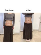 ジョワイユ(Joyeux)/腸の位置でお腹は変わる