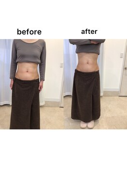 ジョワイユ(Joyeux)/腸の位置でお腹は変わる