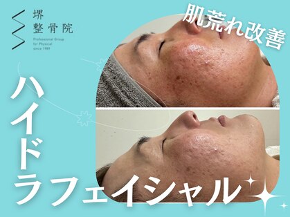 堺整骨院 小郡院の写真