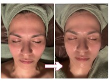 ルーチェ(LUCE)/贅沢肌別パック小顔フェイシャル