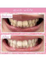 エクシアホワイト SOKA(ecxia white)/