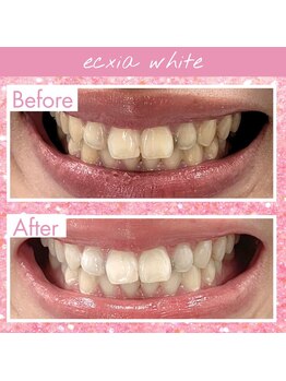 エクシアホワイト SOKA(ecxia white)/