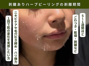 アンテサロン 関内店(Antesalon)/ヒト幹細胞上清液入りハーブ☆