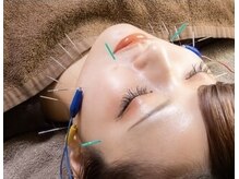 鍼灸ハリカラの雰囲気（むくみ・たるみに◎堺市/小顔矯正/肌質改善/眼精疲労/美容鍼）
