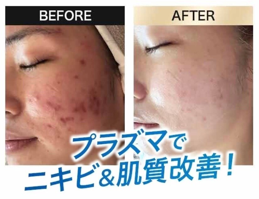 岡本駅でピーリングが人気のエステサロン｜ホットペッパービューティー