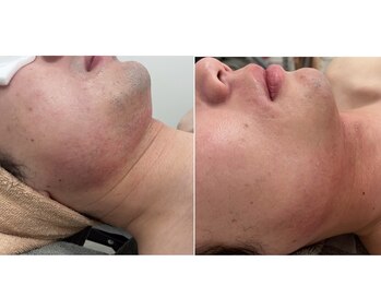 スリーク(threek)/