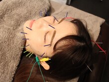 サボ 表参道 原宿(SABO)/お顔の電気鍼｜美容鍼×整体SABO