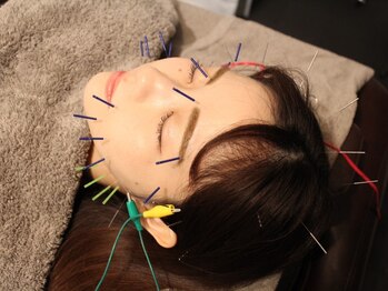 サボ 表参道 原宿(SABO)/お顔の電気鍼|美容鍼×整体SABO