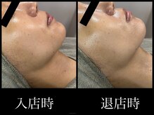 ビーエルティー(blt)/レモンボトル