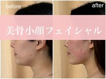 ミミ アイ(MIMI eye.)