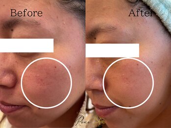 ポノ(Pono)/ホームケアでツヤ肌を☆