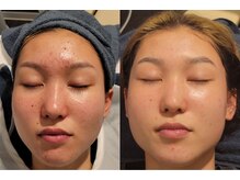 シャルトルズ 広島八丁堀店の雰囲気（モデル・アスリート来店サロン/実績11年）