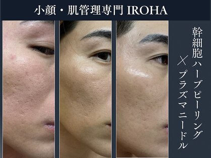 イロハ(IROHA)の写真