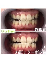 ルブラン 奈良店(Le Blanc)/ご都合の良い日に。。。