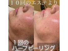 エレナ(Elena)/お肌が育つ