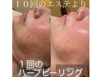 エレナ(Elena)/お肌が育つ