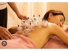 たくろう鍼灸院 豊田本院/【吸い玉】