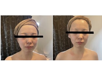 ボーテ エ シャルル(Beaute et chaleur)