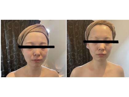ボーテ エ シャルル(Beaute et chaleur)の写真