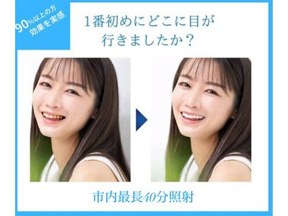 ホワイトニングショップ 米子店の写真