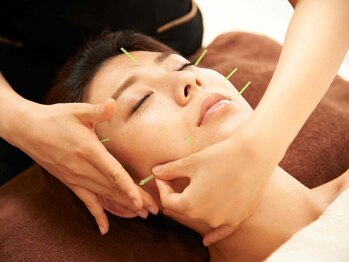 ラ コンシェル 青葉台店の写真/【もたついたフェイスライン・二重顎に◎】美容鍼でフェイスラインを引き締め,理想のスッキリ小顔に♪