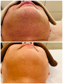 アールイー(Re:)/