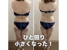 エアリアル 大川店/大人気！戻らない脂肪冷却痩身