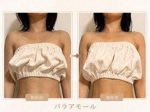 パラアモール(Paraamor)/肩が巻いてしまってる→整う