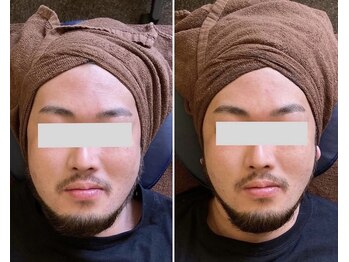 アンドワイ バイ サロンリーナ(&y by Salon Lena)の写真/メンズフェイシャルに特化したサロン☆日頃のお疲れもリラックスしながら解消！