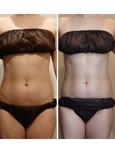 シェリラソワン(Che'rie La Soin)/ビフォーアフター