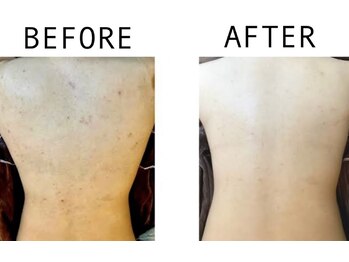 ムーンライズ(moonrise)/