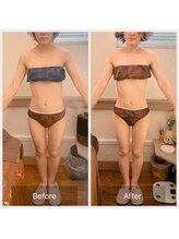 カルナ(carna)/《4か月計8回》2週間に1回