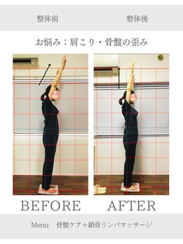 ヨギート(yogate)/整体/小顔/リンパマッサージ