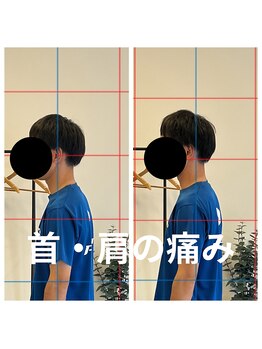 熊本カワル整体 JR上熊本駅院/首・肩の痛み