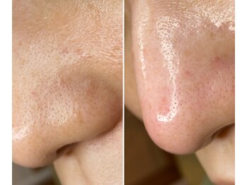 サイ(Sai)/before⇒after