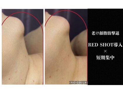 アクアリジェの写真