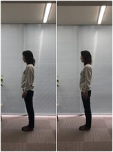 カルペード 中百舌鳥/なかもず院(Carpe D.)/施術後の変化