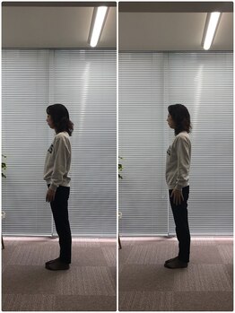 カルペード 中百舌鳥/なかもず院(Carpe D.)/施術後の変化