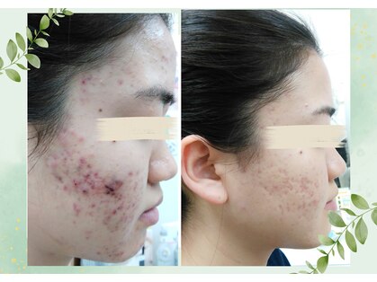 フォーユー 飯能店(Foryou)の写真