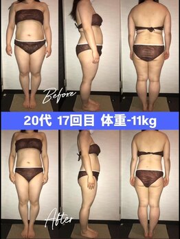 シェイプ 浜松本店/睡眠の質も変わるシェイプ