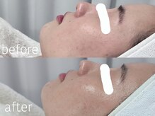 グレイス アンド ミューズ(grace&muse)/【クリスティーナ】アンストレス